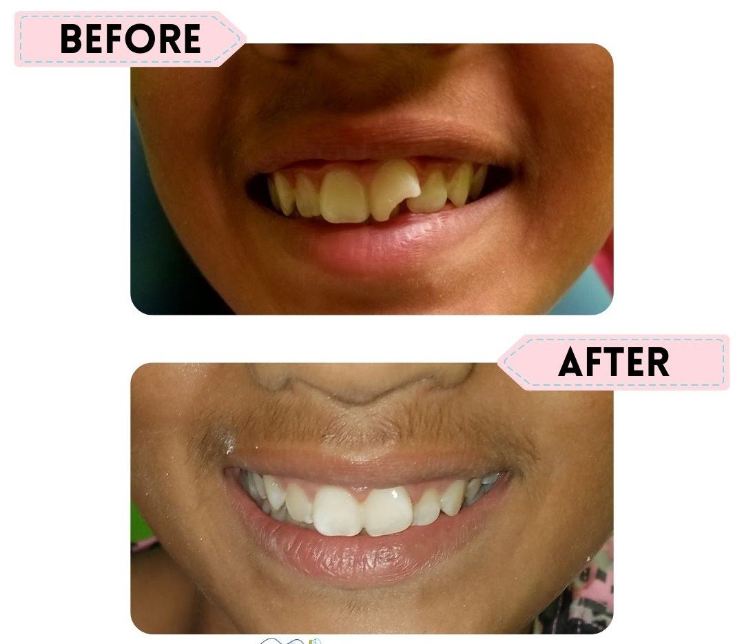 Happy kid after cavity-free dental checkup